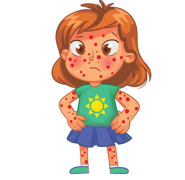 Illustration of a child with a skin rash